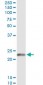 EDN1 Antibody (monoclonal) (M01)