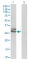 EDN3 Antibody (monoclonal) (M01)