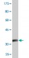 EFHD1 Antibody (monoclonal) (M08)