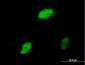 EGR1 Antibody (monoclonal) (M03)