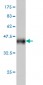 EGR1 Antibody (monoclonal) (M03)