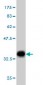 EHD2 Antibody (monoclonal) (M01)