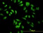 EIF2AK2 Antibody (monoclonal) (M01)