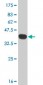 EIF2AK2 Antibody (monoclonal) (M01)