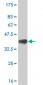 EIF2AK2 Antibody (monoclonal) (M02)