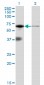 EIF2AK2 Antibody (monoclonal) (M02)
