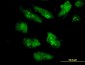 EIF2AK2 Antibody (monoclonal) (M03)