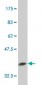 EIF2AK2 Antibody (monoclonal) (M03)