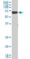 EIF2AK2 Antibody (monoclonal) (M03)