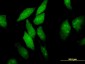 EIF4ENIF1 Antibody (monoclonal) (M01)