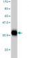 EIF4G2 Antibody (monoclonal) (M01)