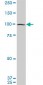 EIF4G2 Antibody (monoclonal) (M01)