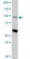 EIF4G2 Antibody (monoclonal) (M01)