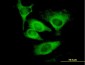 EIF5 Antibody (monoclonal) (M01)