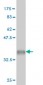 EIF5A2 Antibody (monoclonal) (M01)