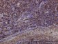 EMD Antibody (monoclonal) (M01)