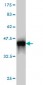 EMD Antibody (monoclonal) (M01)