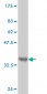 ENC1 Antibody (monoclonal) (M02)