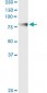 ENG Antibody (monoclonal) (M01)