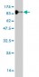 ENG Antibody (monoclonal) (M01)