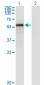ENG Antibody (monoclonal) (M01)