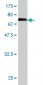 ENO1 Antibody (monoclonal) (M01)