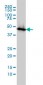 ENO1 Antibody (monoclonal) (M01)