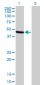 ENO1 Antibody (monoclonal) (M01)