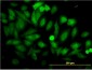 ENO1 Antibody (monoclonal) (M01)