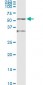 ENO1 Antibody (monoclonal) (M01)