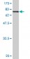 ENO1 Antibody (monoclonal) (M03)