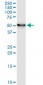 ENO1 Antibody (monoclonal) (M03)