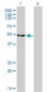 ENO2 Antibody (monoclonal) (M01)