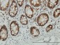 ENO3 Antibody (monoclonal) (M01)