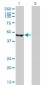 ENO3 Antibody (monoclonal) (M01)