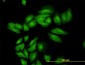 ENO3 Antibody (monoclonal) (M01)