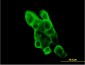 EPHA2 Antibody (monoclonal) (M02)