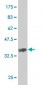 EPHA2 Antibody (monoclonal) (M02)