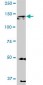 EPHA2 Antibody (monoclonal) (M02)