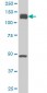 EPHA2 Antibody (monoclonal) (M02)