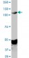 EPHA2 Antibody (monoclonal) (M02)