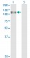 EPHA6 Antibody (monoclonal) (M01)