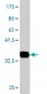 EPM2AIP1 Antibody (monoclonal) (M02)