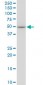 EPOR Antibody (monoclonal) (M01)