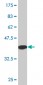 EPOR Antibody (monoclonal) (M02)