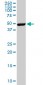 EPOR Antibody (monoclonal) (M02)