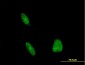 ERCC1 Antibody (monoclonal) (M01)