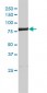 ERCC2 Antibody (monoclonal) (M01)