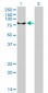 ERCC2 Antibody (monoclonal) (M01)