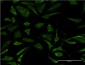 ERCC2 Antibody (monoclonal) (M04)